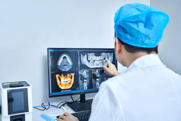 Best Emergency Tooth Extraction in Fountain Valley, CA